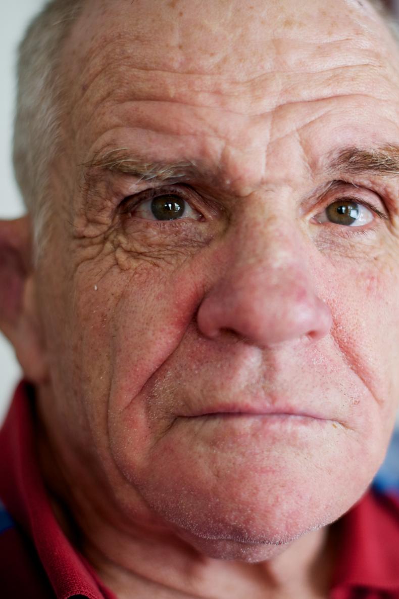 Older man with disability looking at the camera